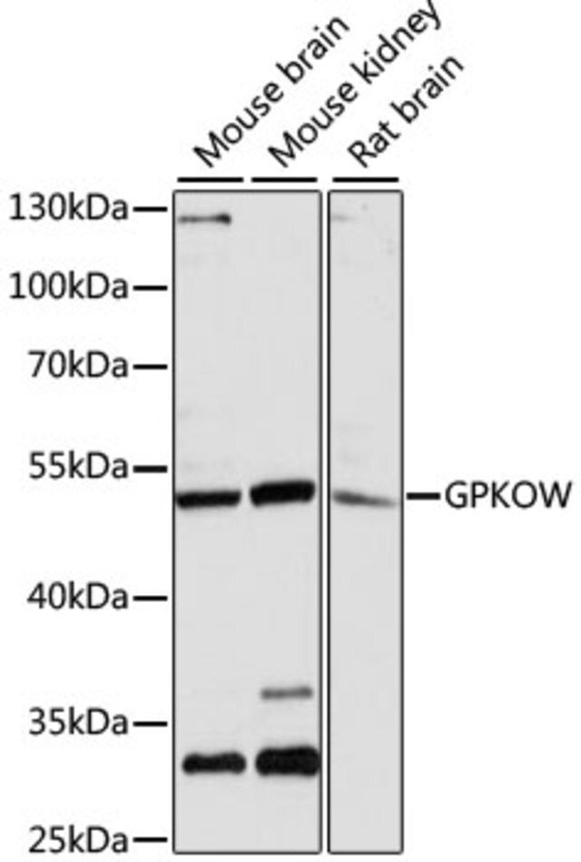 Anti-GPKOW antibody produced in rabbit