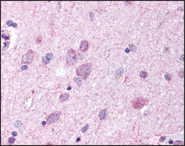 Anti-GPR37 (AB1) antibody produced in rabbit