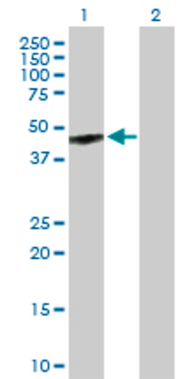 Anti-GPR143 antibody produced in mouse