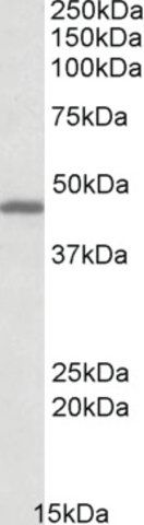 Anti-GPR17 (C-terminal) antibody produced in goat