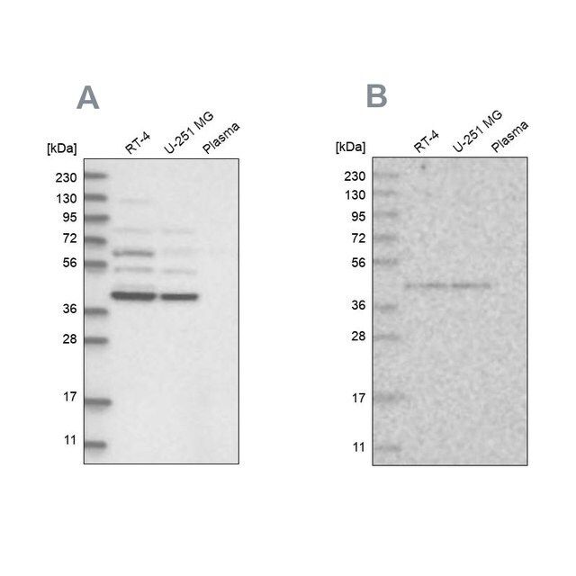 Anti-GPN1 antibody produced in rabbit