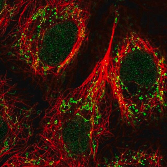 Anti-GPR87 antibody produced in rabbit