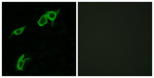 Anti-GPR75 antibody produced in rabbit