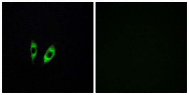 Anti-GPR156 antibody produced in rabbit