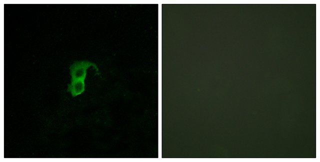 Anti-GPR87 antibody produced in rabbit