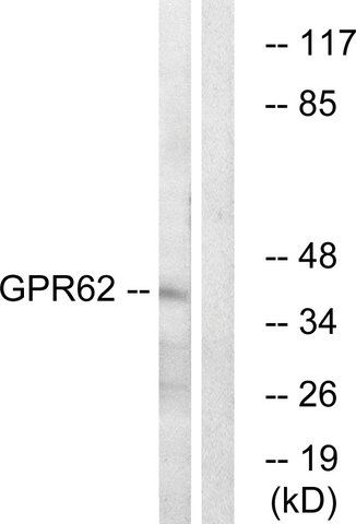 Anti-GPR62 antibody produced in rabbit