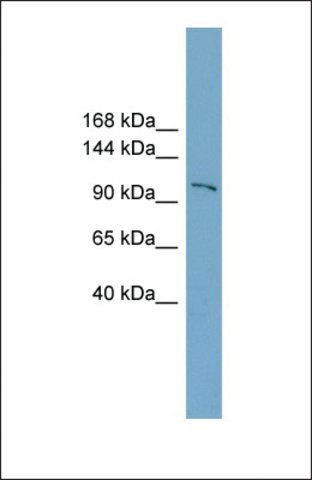 Anti-FTSJD1 antibody produced in rabbit