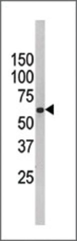 Anti-FUBP3 (center) antibody produced in rabbit