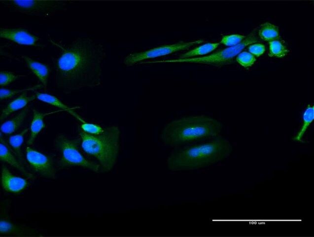 Anti-FUK antibody produced in rabbit