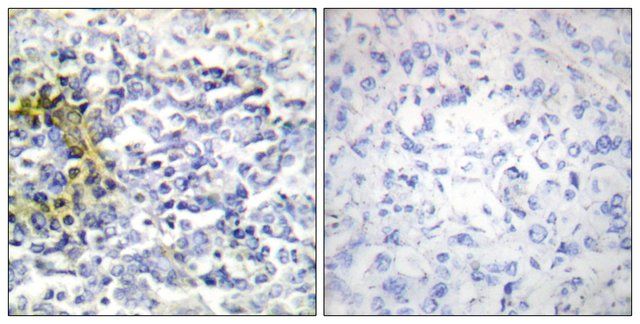 Anti-FXR2 antibody produced in rabbit