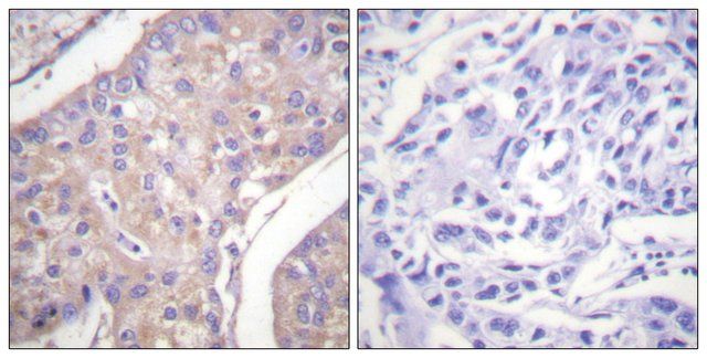 Anti-GAB1 antibody produced in rabbit