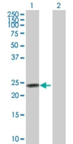 Anti-FXN antibody produced in rabbit