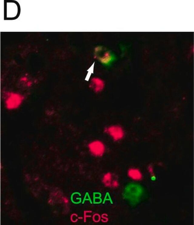 Anti-GABA Antibody