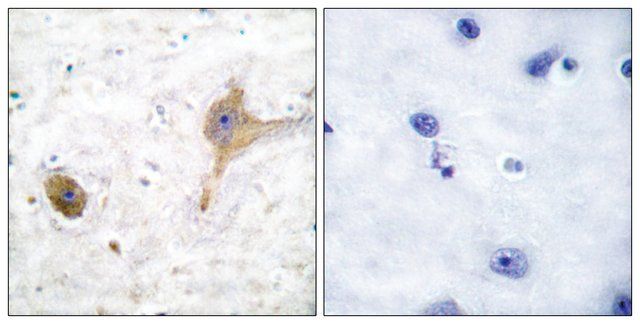 Anti-GABA-B Receptor antibody produced in rabbit