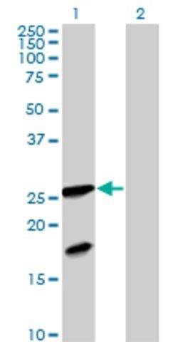 Anti-FXN antibody produced in mouse