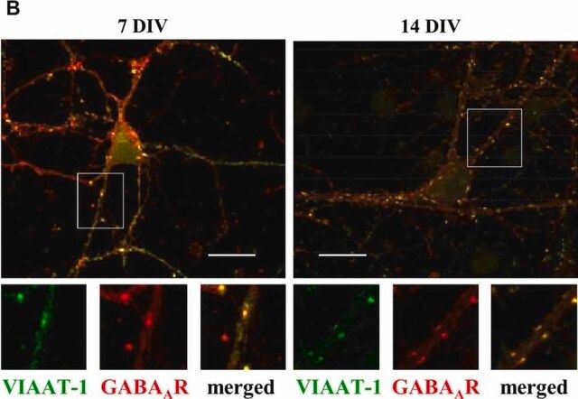 Anti-GABA A Receptor  2,3 Chain Antibody, clone BD17