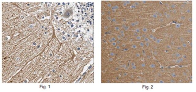 Anti-GABA-B receptor 2 Antibody, clone N81/37