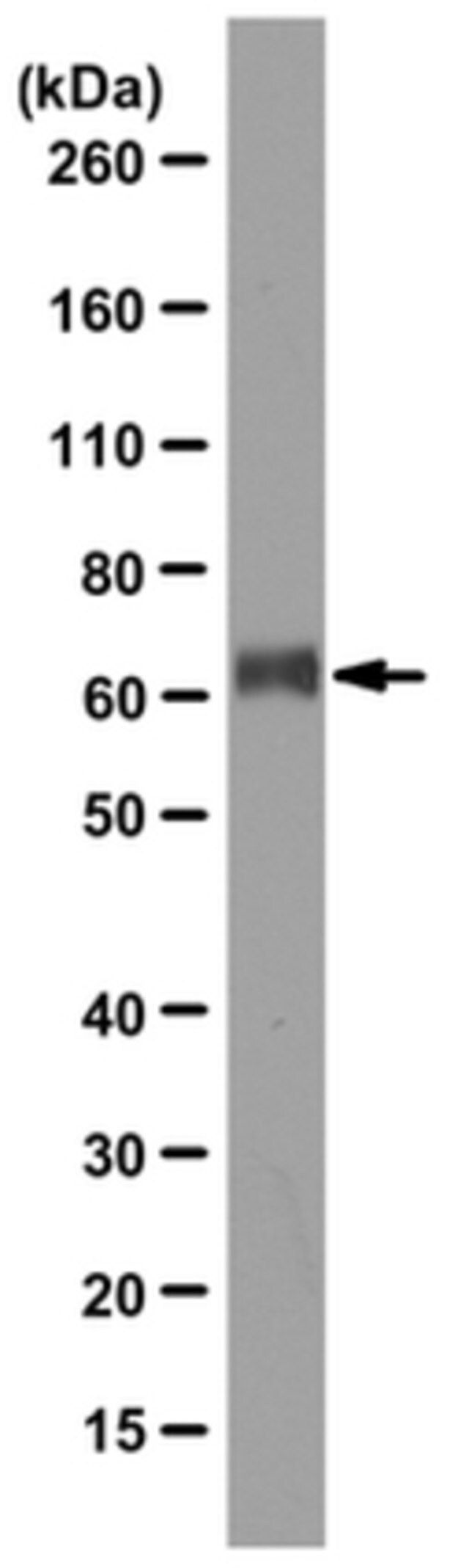 Anti-G-protein coupled receptor 56 (GPR56) Antibody, clone H11