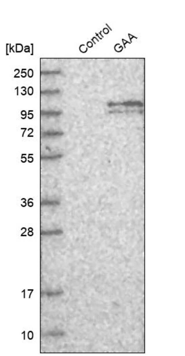 Anti-GAA antibody produced in rabbit