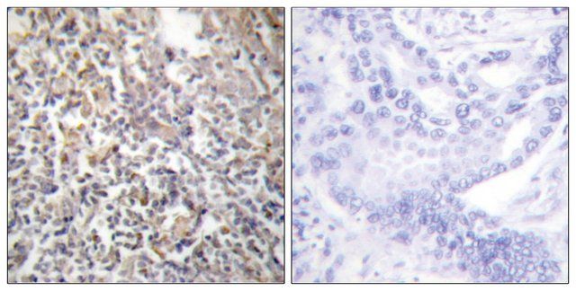 Anti-Fibronectin 1 antibody produced in rabbit