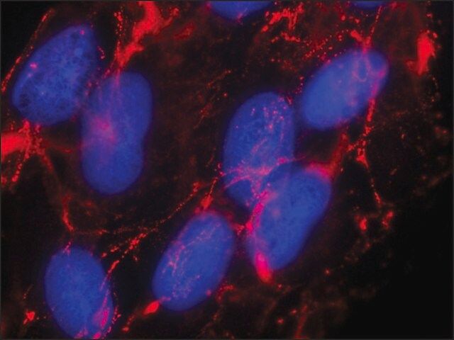 Anti-Fibronectin antibody, Mouse monoclonal