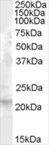 Anti-Fibroblast Growth Factor 21 antibody produced in goat