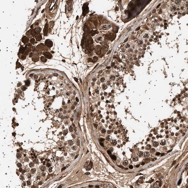 Anti-FICD antibody produced in rabbit