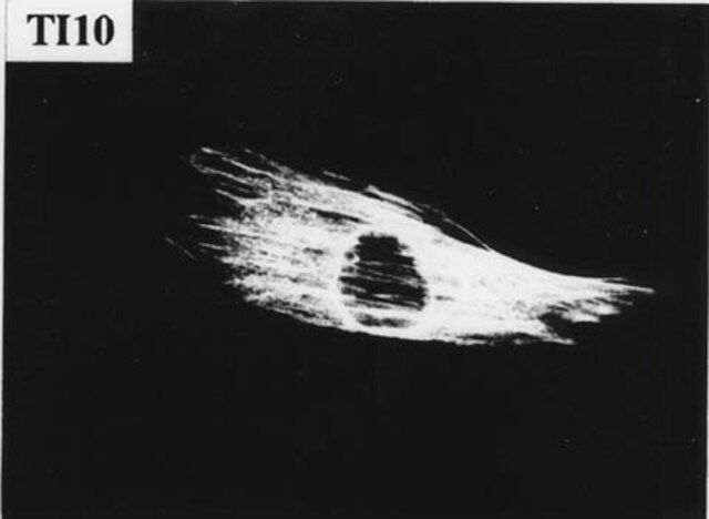 Anti-Filamin A Antibody, clone TI10