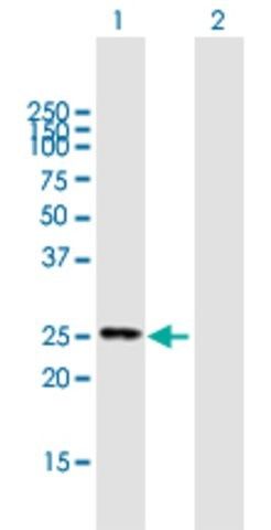 Anti-FIGLA antibody produced in mouse