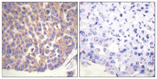 Anti-Filamin A antibody produced in rabbit