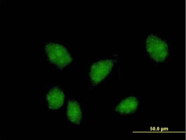 Anti-FKBPL antibody produced in mouse