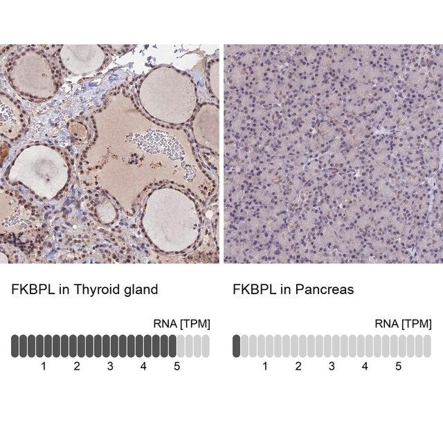 Anti-FKBPL antibody produced in rabbit