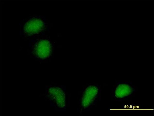 Anti-FLJ39378 antibody produced in mouse