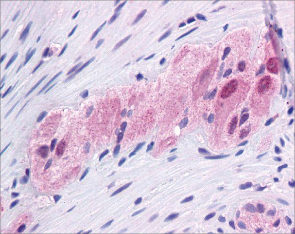 Anti-FOXC1, (N-terminal) antibody produced in rabbit