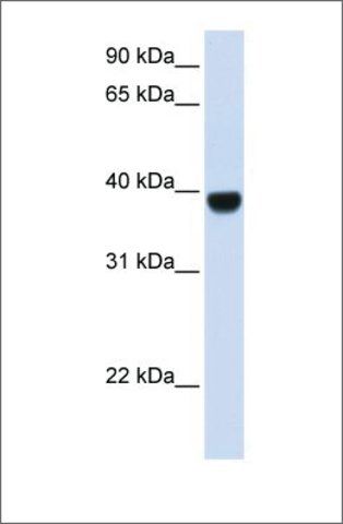 Anti-FOXE1 antibody produced in rabbit