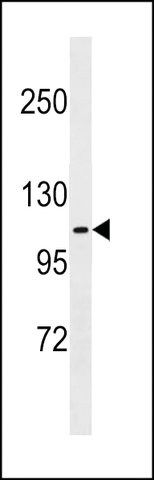 ANTI-FARP1(N-TERMINAL) antibody produced in rabbit