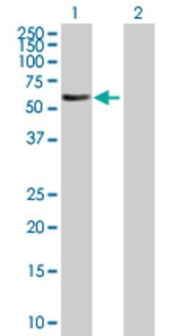 Anti-FBXL6 antibody produced in mouse