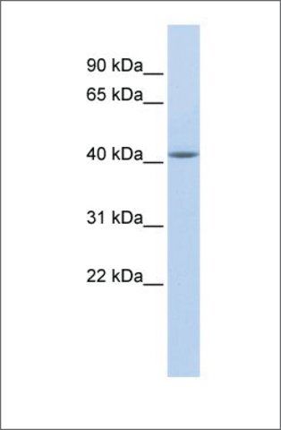 Anti-EPSTI1 antibody produced in rabbit