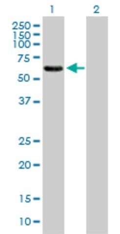 Anti-EPS8L1 antibody produced in mouse