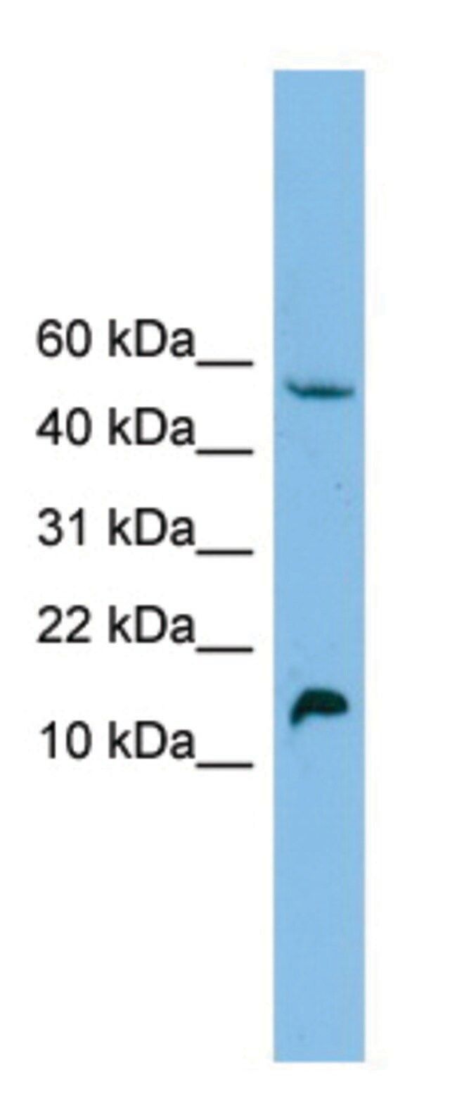 Anti-EPO antibody produced in rabbit