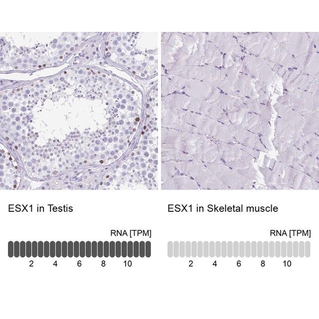 Anti-ESX1 antibody produced in rabbit