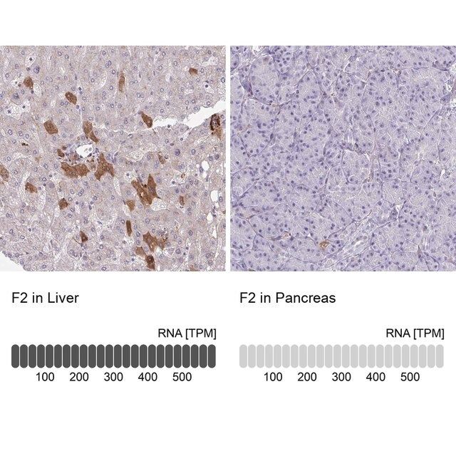 Anti-F2 antibody produced in rabbit