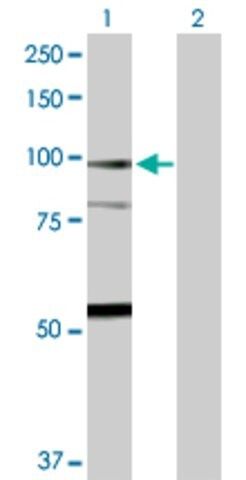 Anti-F13A1 antibody produced in rabbit