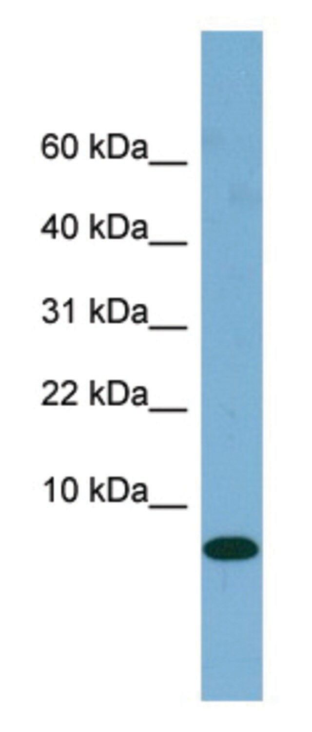 Anti-FABP1 (N-terminal) antibody produced in rabbit