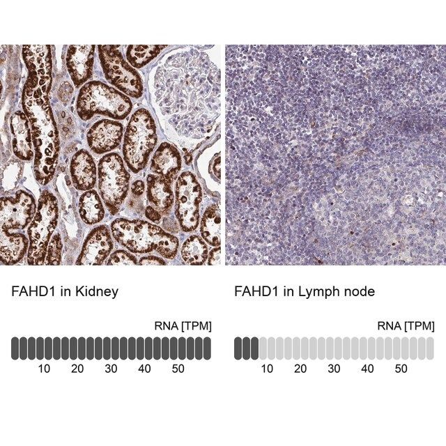 Anti-FAHD1 antibody produced in rabbit