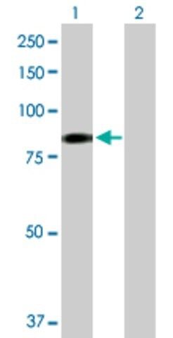 Anti-EHHADH antibody produced in rabbit