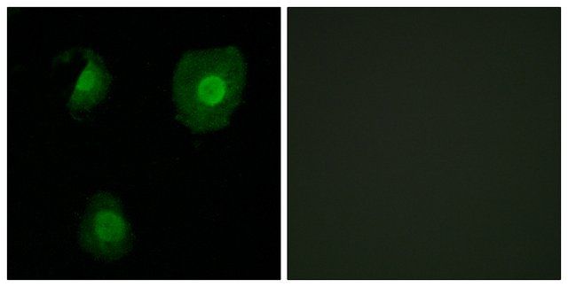 Anti-EID1 antibody produced in rabbit