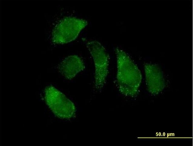 Anti-EHHADH antibody produced in mouse