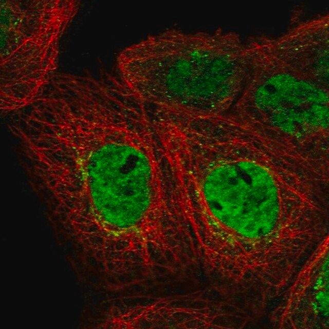 Anti-EHF antibody produced in rabbit