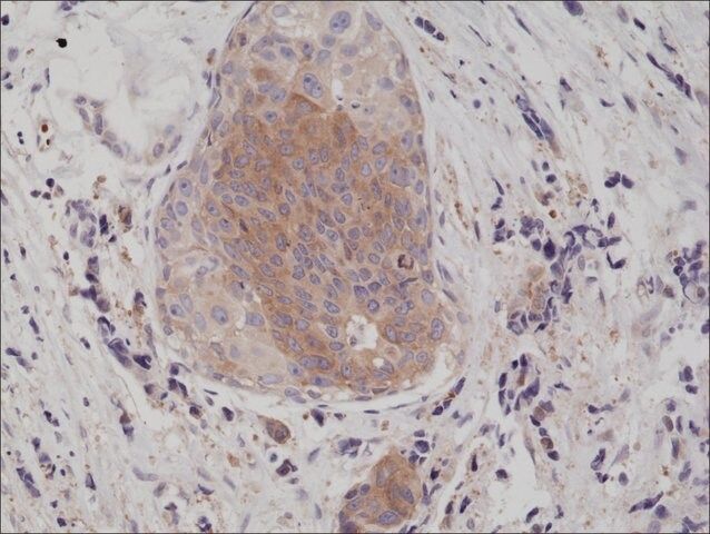 Anti-eIF-2 alpha (Ser51) antibody, Rabbit Monoclonal